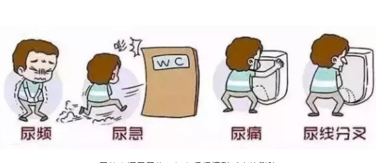 滄州男性的前列炎哪看好？保養(yǎng)前列腺的方法(圖1)